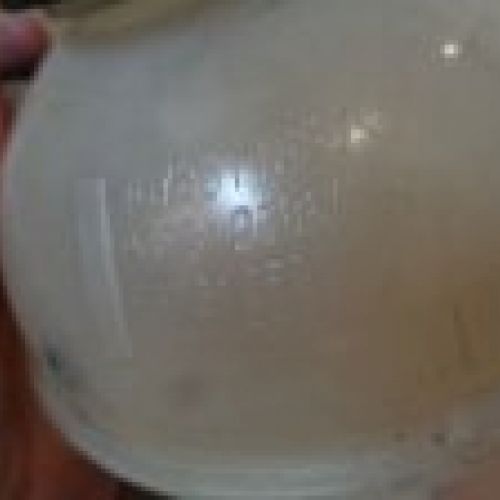 VASO EXPANSIÓN CITROEN BERLINGO 2019 1